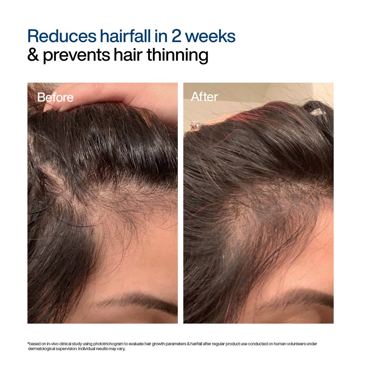 WishCare Hair Growth Serum Concentrate 30ml - Image 8