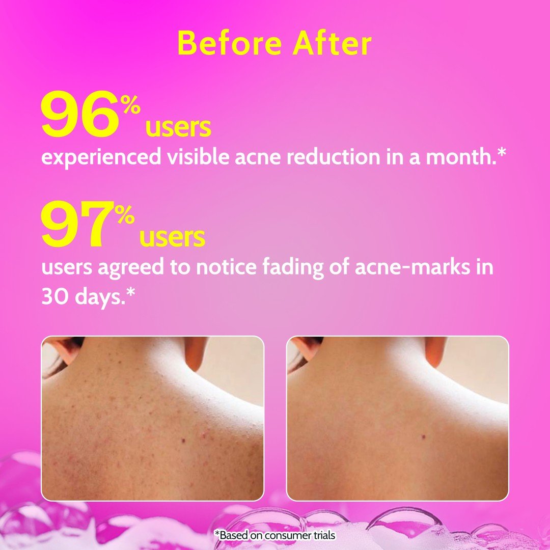 Chemist at Play 1% Salicylic Acid Body Wash - Image 4