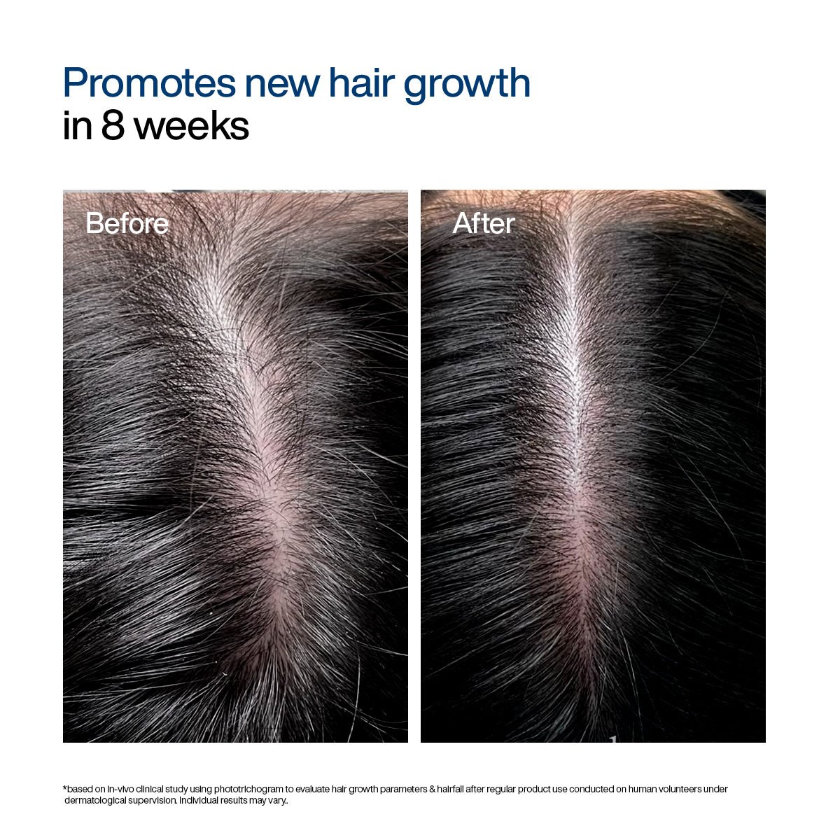 WishCare Hair Growth Serum Concentrate 30ml - Image 6