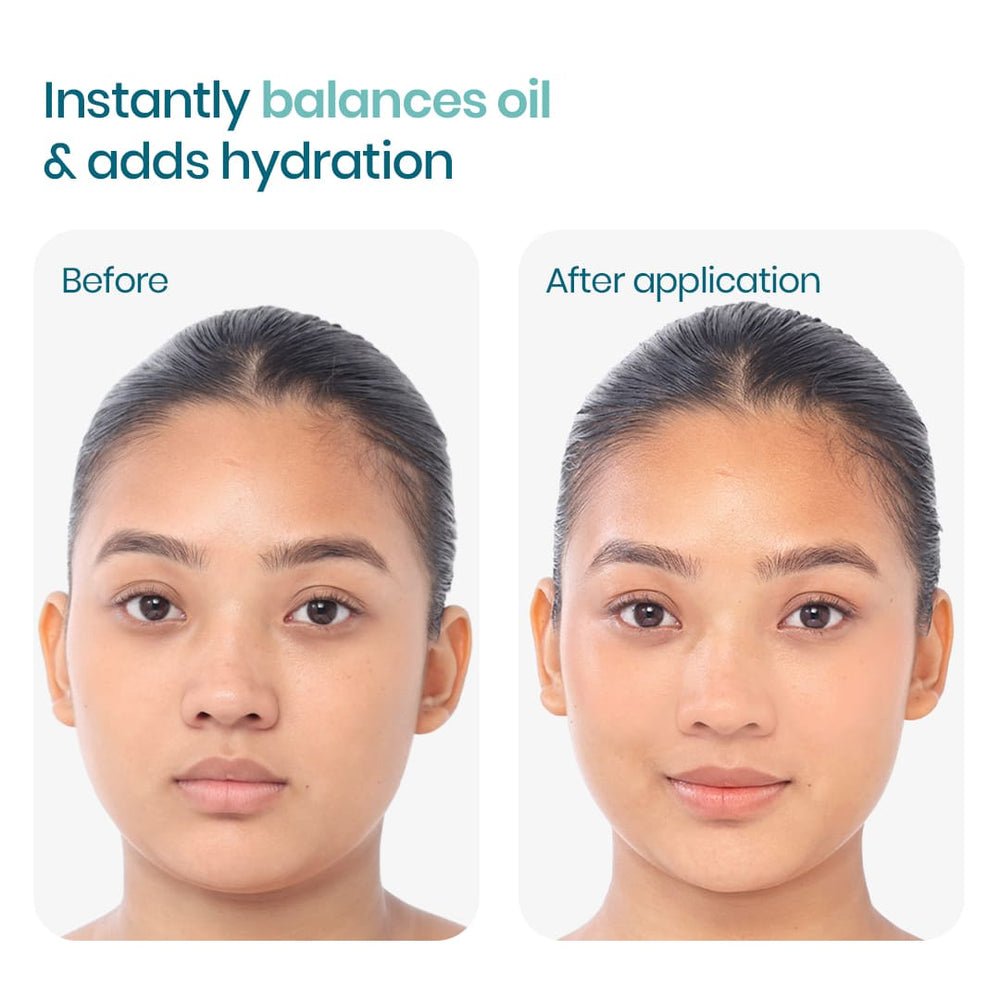 WishCare 2:1:3 NMF Water Gel Moisturizer - Image 5