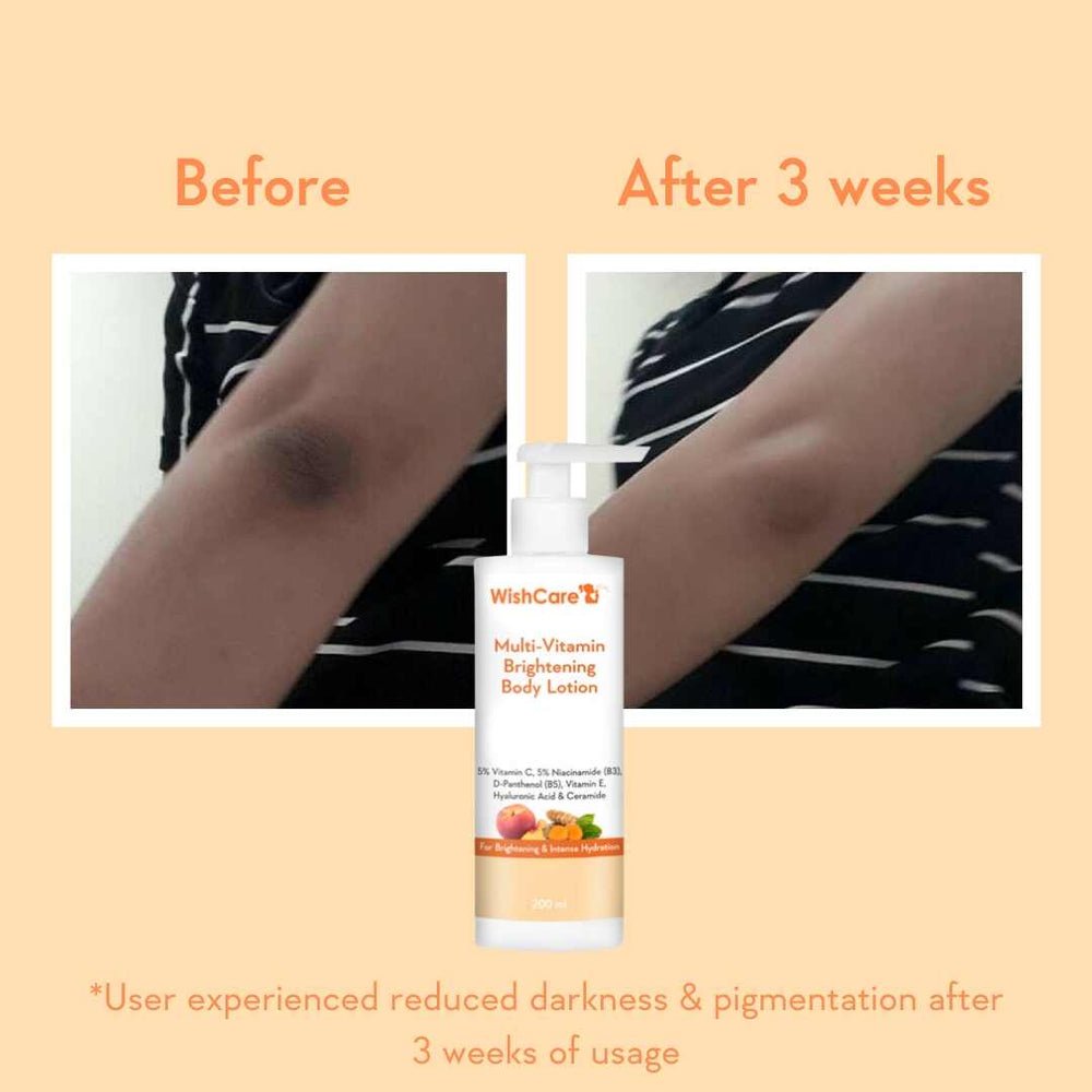 WishCare Multi-Vitamin Brightening Body Lotion (200 ml) - Image 5