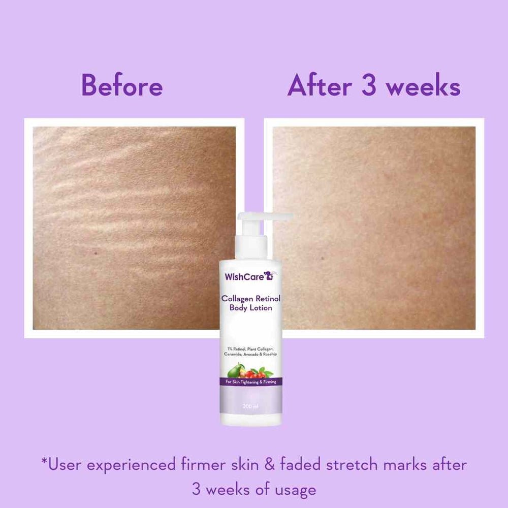 WishCare Collagen Retinol Body Lotion(200) - Image 5