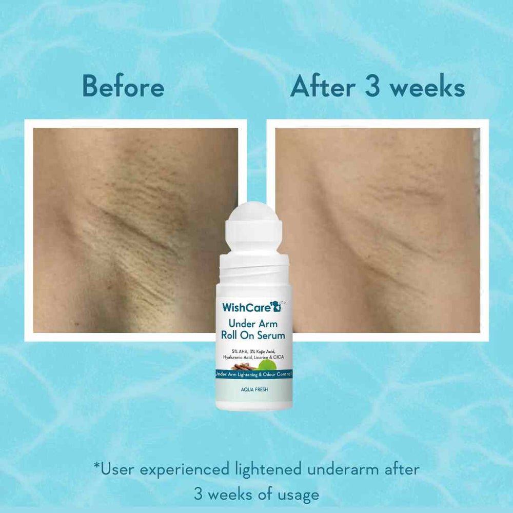 WishCare Underarm Roll On Serum (Aqua Fresh) - Image 6